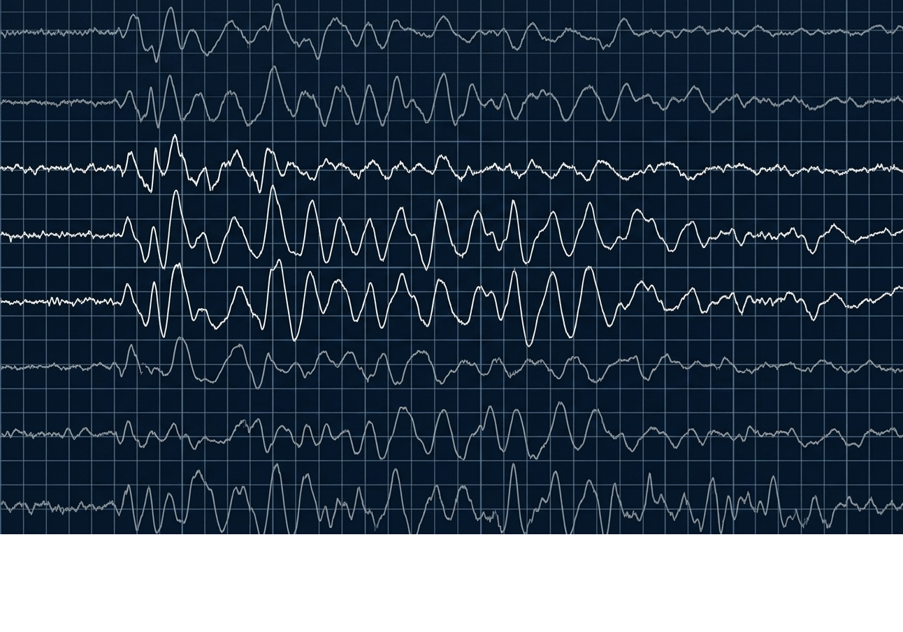 What Sleep Deprivation Does to Your IQ Score