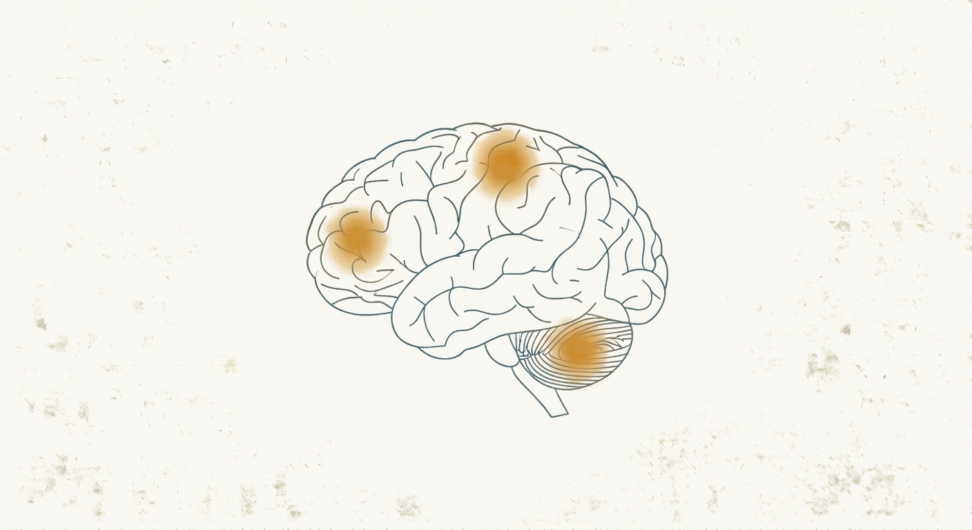 Exercise and Brain Health: How Physical Activity Affects Cognitive Performance